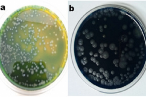 Carr agar medium (a) After acetic acid production (b) After over oxidation