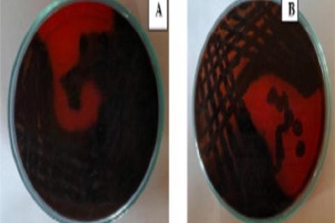 Colonies of isolated strains producing exopolysaccharide on Congo red agar with 50 g/l of sucrose. A - black or almost black colonies (positive), B - black or almost black colonies (positive)