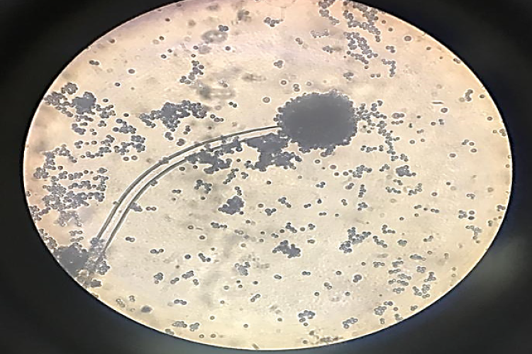 Lactophenol cotton blue staining of Aspergillus niger.