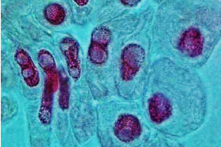 Fragmentation of Nucleus