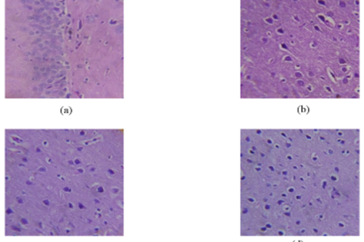 Histopathological examination of the brain (a) control male (b) control female (c) high dose male (d) high dose female.