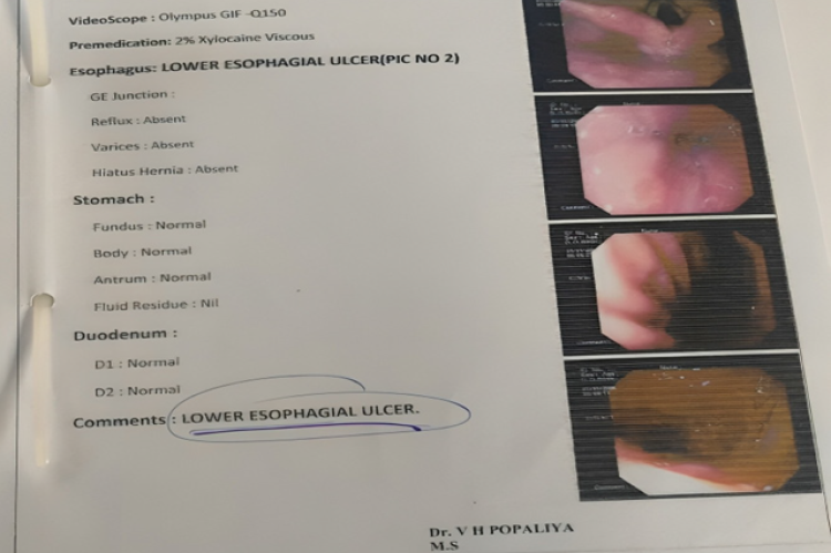 1st Upper GI Endoscopy