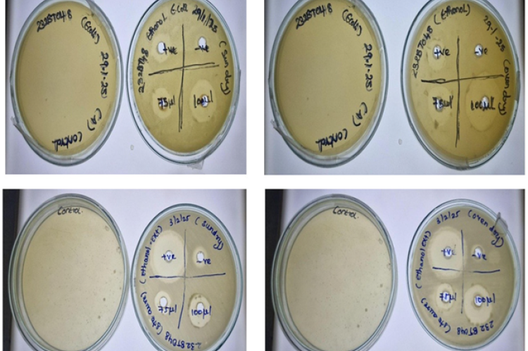Antimicrobial activity of Metapenaeus dobsoni. (a) Anti-microbial activity of Metapenaeus dobsoni (Escherichia coli), (b) Anti-microbial activity of Metapenaeus dobsoni (Staphylococcus aureus).