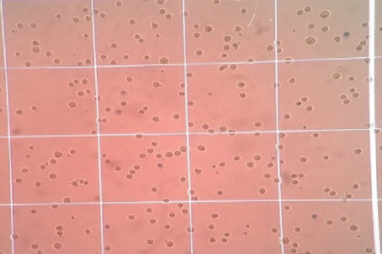 Effect of the extract on mouse DLA cell lines.