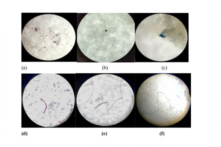 Microscopical photographs of Microplastics