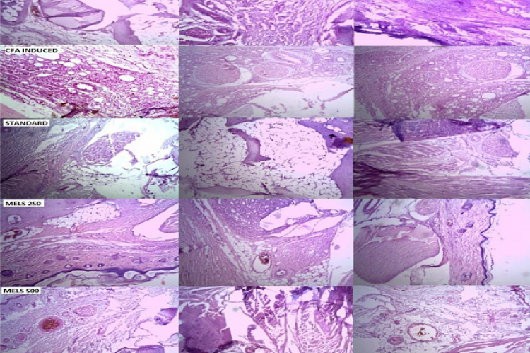 Histopathological representation of tibiotarsal joints stained with H&E of Normal rat, CFA induced rat, Piroxicam
