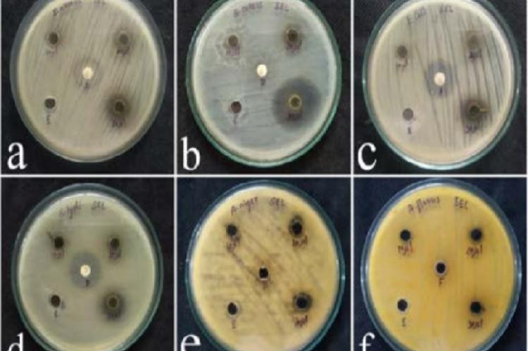 Antimicrobial analysis of ethanol leaf extracts of Bridelia montana against (a) Staphylococus aureus (b)
