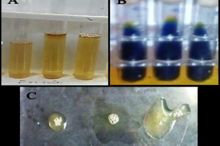 Image showing the various biochemical tests. Voges-Proskauer test (A), Citrate utilization test (B) and Coagulase test (C).