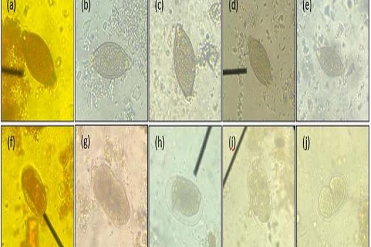 Stained ova of Soil Transmitted-Helminths (a) to (e) Demonstrated the egg of Trichuris suis and (f) to (j) demonstrated the egg of Strongyloides ransomi. (a) Lugol’s iodine. (b) Ethanol extract of Mangosteen. (c) Distilled water extract of Mangosteen. (d) Ethanol extract of Dragon fruit. (e) Distilled water extract of dragon fruit. (g) Ethanol extract of Mangosteen. (h) Distilled water extract of Mangosteen. (i) Ethanol extract of Dragon fruit. (j) Distilled water extract of dragon fruit.