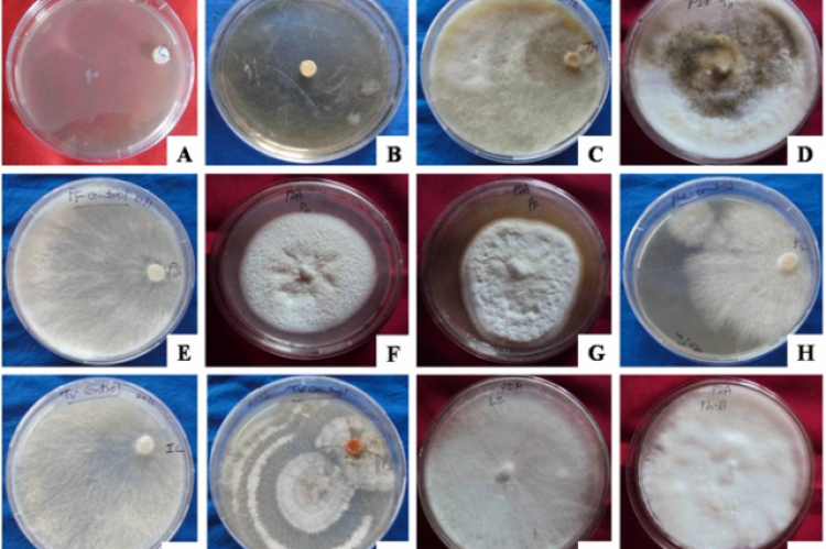 (A-L) Colony characteristics features of fungal isolates on PDA medium   