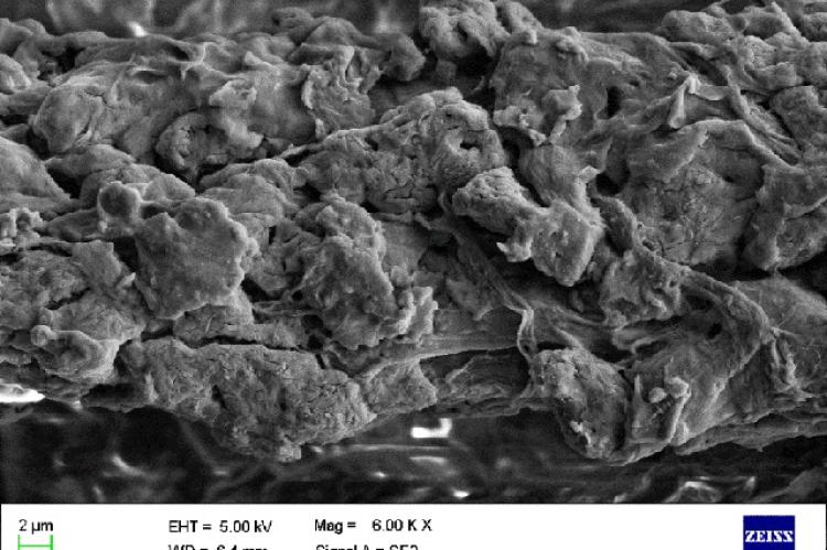 Coated-Cefixime+Ciprofloxacin