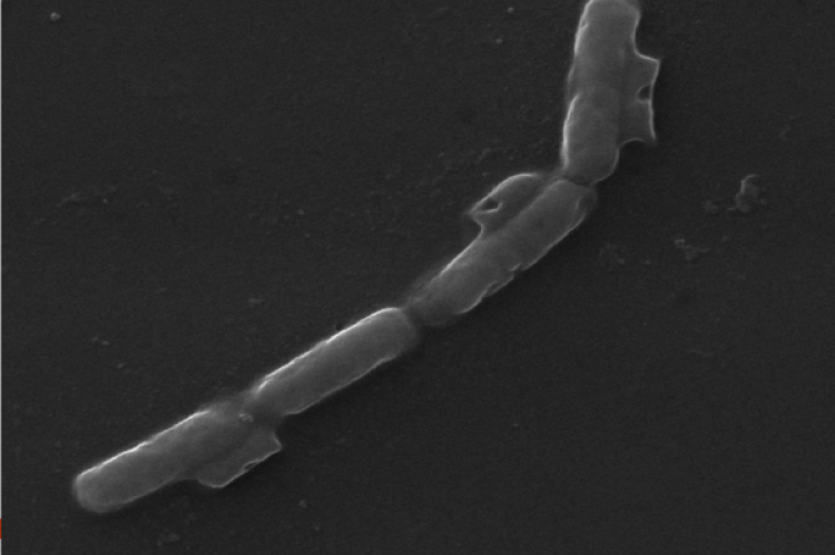Scanning electron micrograph of  cells of  Klebsiella variicola PRBC 14