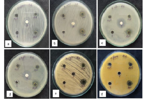 Antimicrobial analysis of ethanol leaf extracts of Tinospora crispa against (a) Staphylococus aureus