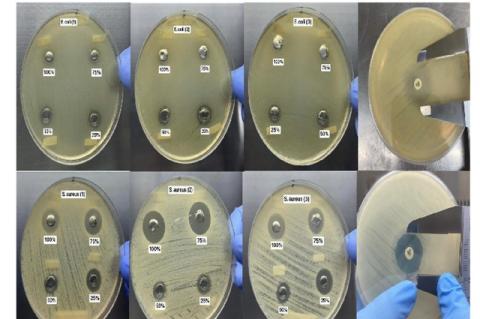 The results of the Agar Well Diffusion Test that shows the Zone of Inhibition of S. aureus and E. coli against the Different Concentrations of the green synthesized CuONPs and control.