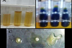 Image showing the various biochemical tests. Voges-Proskauer test (A), Citrate utilization test (B) and Coagulase test (C).